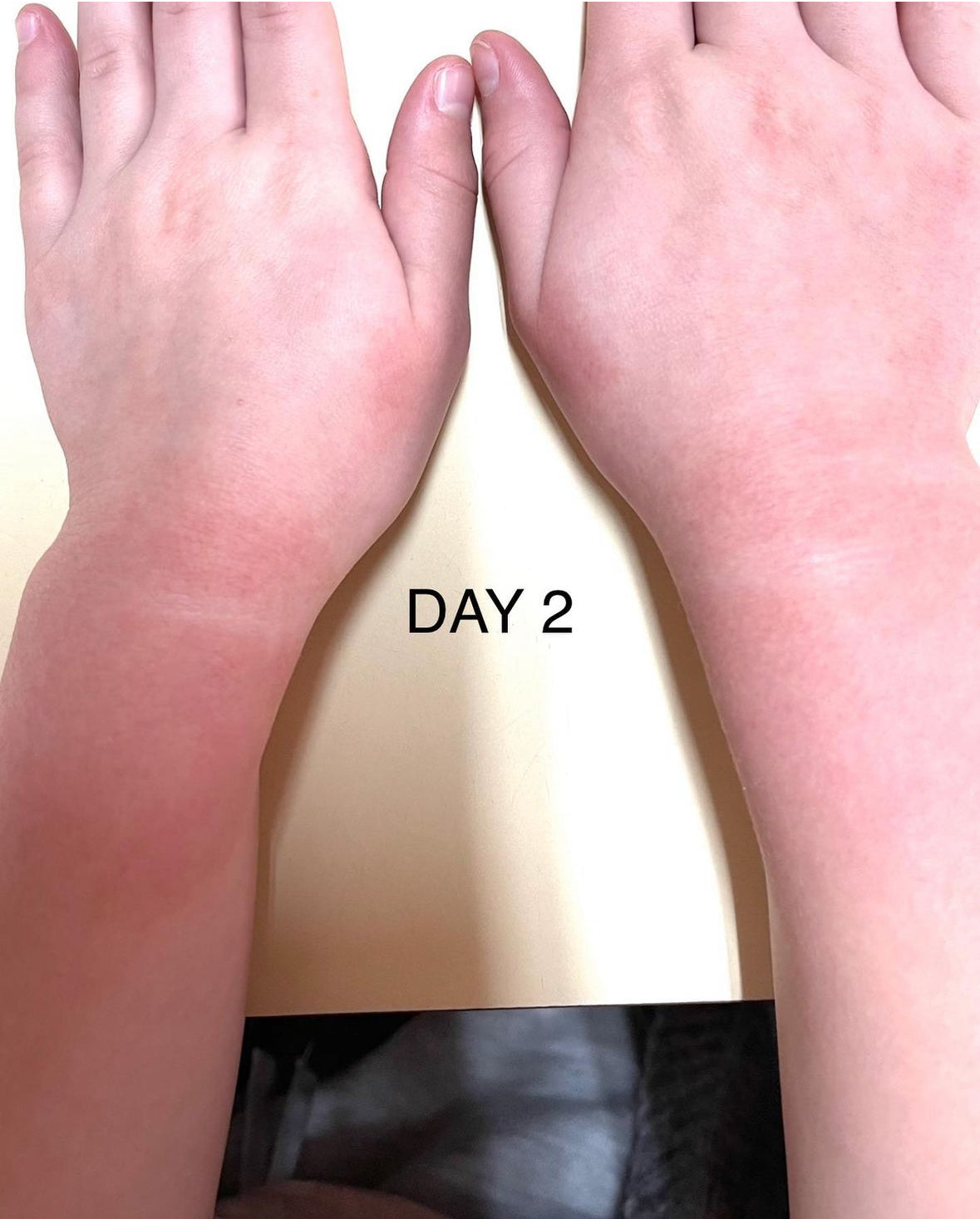 R&R-RESTORATIVE REMEDY BALM