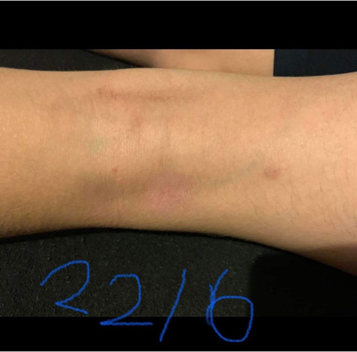 R&R-RESTORATIVE REMEDY BALM